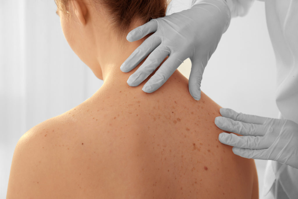 cure thermale en dermatologie