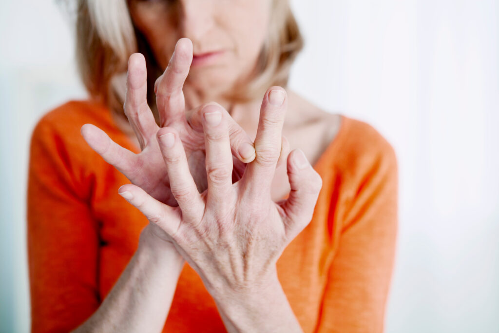 arthrite rhumatoïde